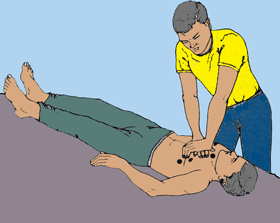 Poziția pentru masaj cardiac